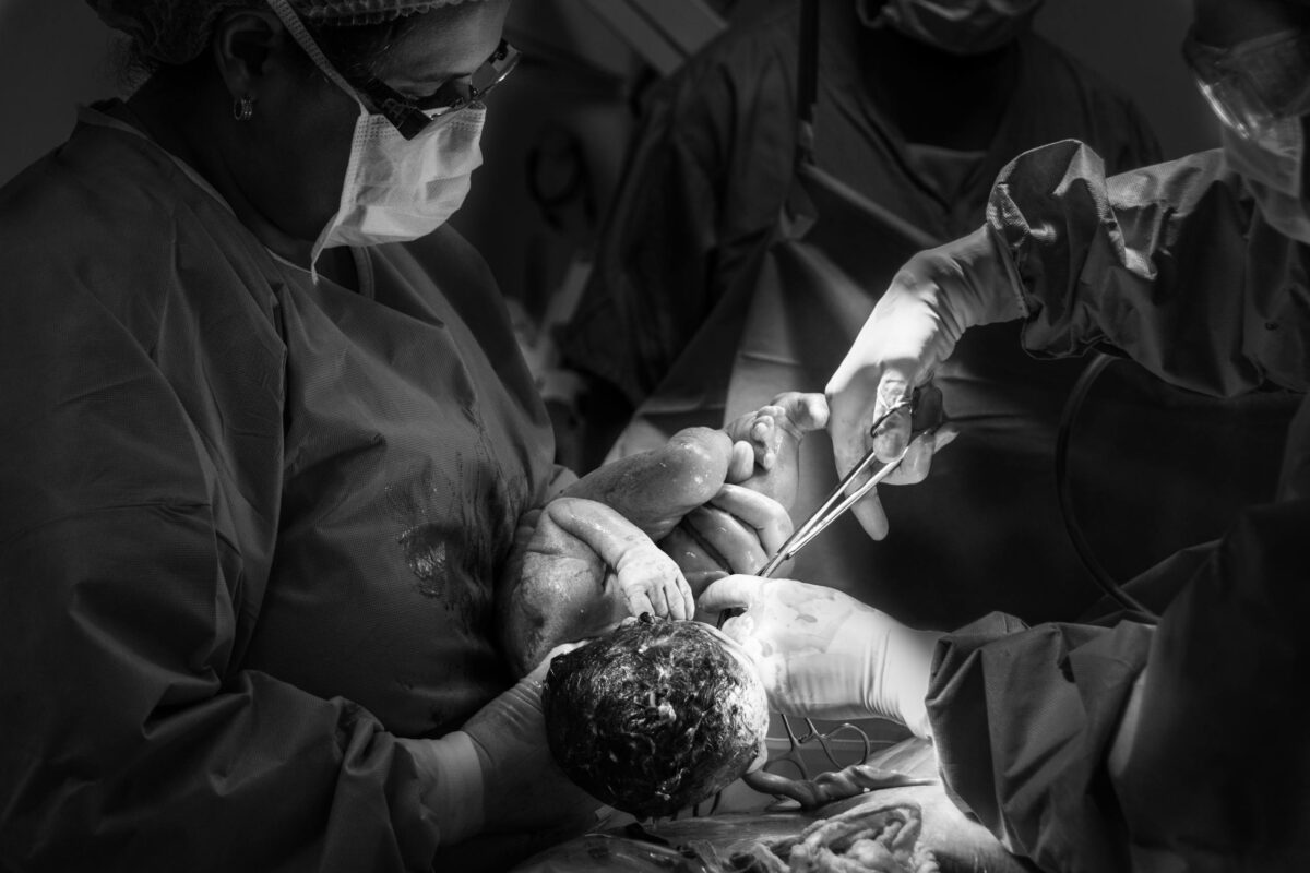 c-section recovery: Black and white photo of a newborn delivery in a hospital operating room.